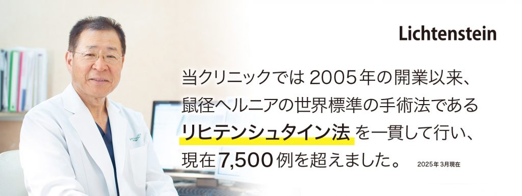 リヒテンシュタイン法